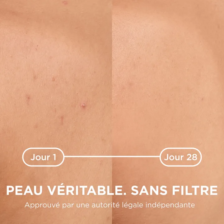 Sébium Kerato+ Body Anti-Imperfections Spray Bioderma 150ml 