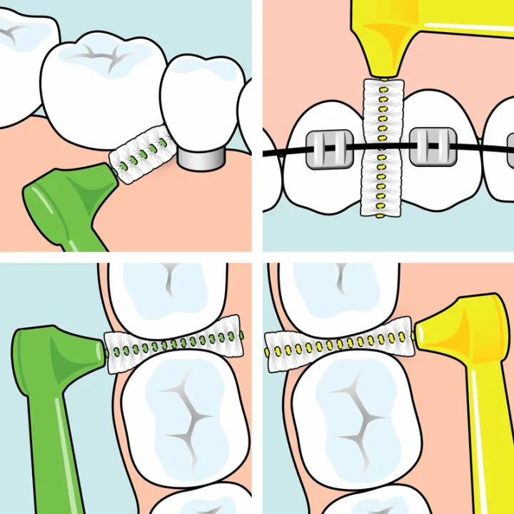 Tepe Interdental Brushes Angle with Handle x6