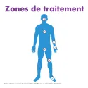 Excilor ZéroVerrue Freeze 10 ml